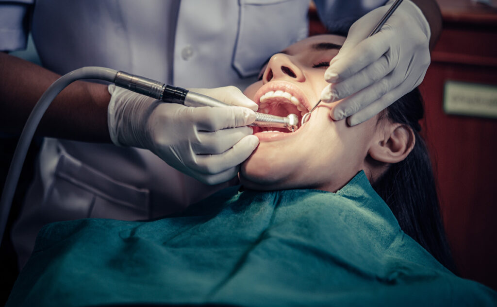 Carie ai denti sintomi e cause
